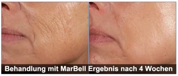 MarBell - Active Skin Serum