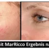 MarRicco - Body Repair Concentrate