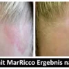 MarRicco - Body Repair Concentrate