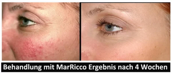 MarRicco - Body Repair Concentrate